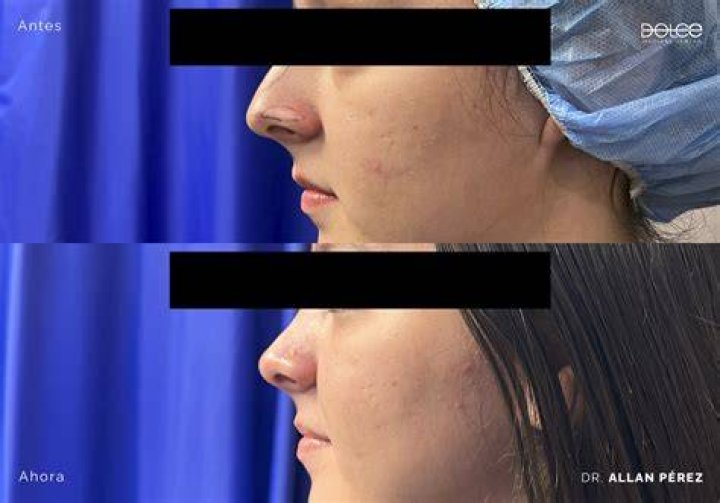 Antes y despu&eacute;s as&iacute; luc&iacute;a Karely Ruiz antes de las cirug&iacute;as La Sabrosita