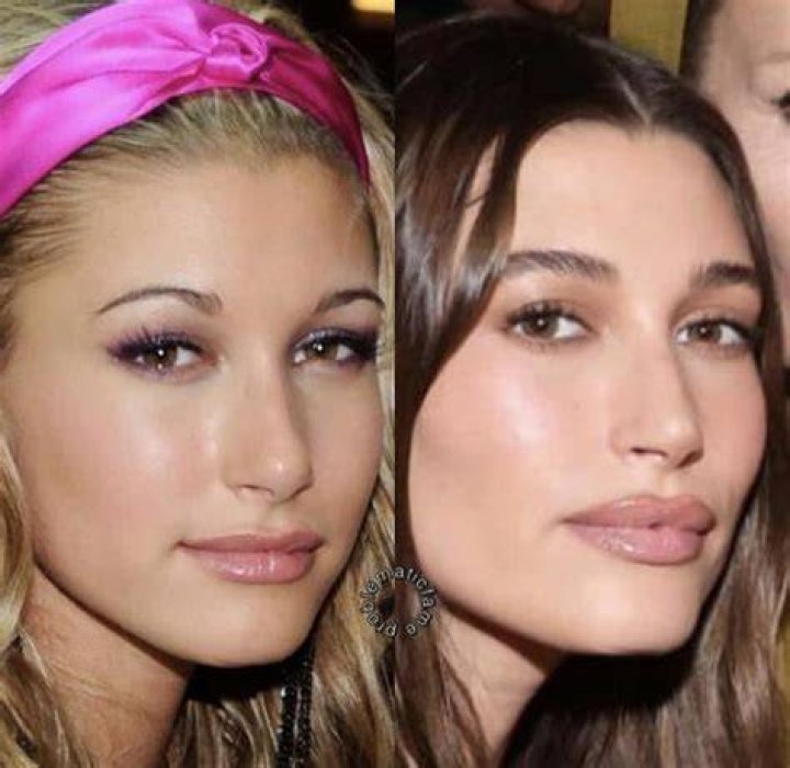 Did She Get Nose Job?