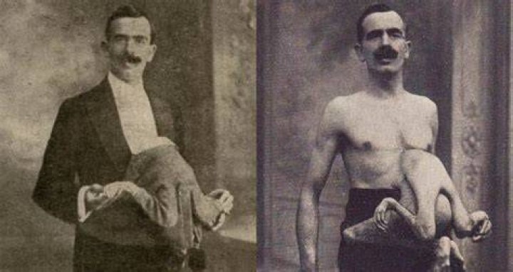 Jean Libbera & Vestigial Twin Circus Sideshow Freak Modern Postcard