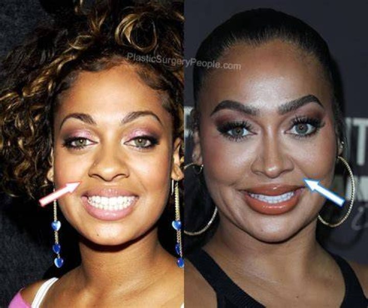 Lala Anthony, Before and After BSS news