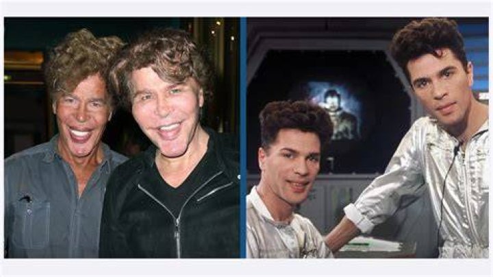 New Celebrity Buzz Bogdanoff Brothers Before After Plastic Surgery