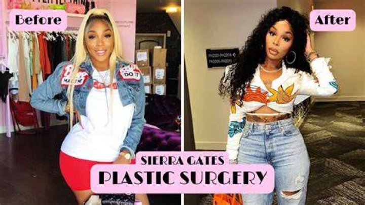 Sierra Gates Before Plastic Surgery – Is She Related To Kevin Gates?