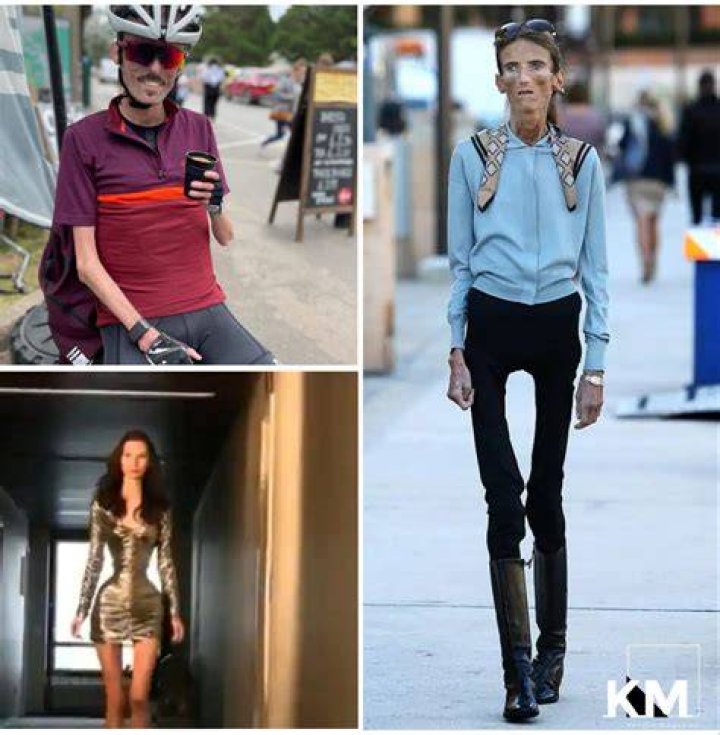 Skinniest People in the World Top 5 People Ramone's World