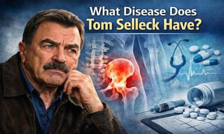 What Disease Does Tom Selleck Have? Tom Selleck Health? Did Tom Selleck