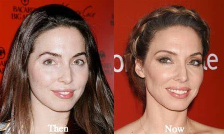 Whitney Cummings Plastic Surgery Before And After